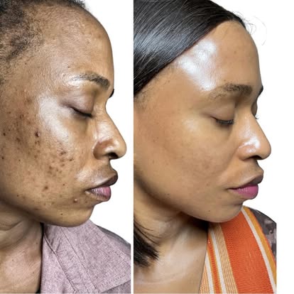 Publication Instagram de Melbady Beauty Center